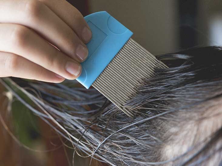 Head Lice Treatment