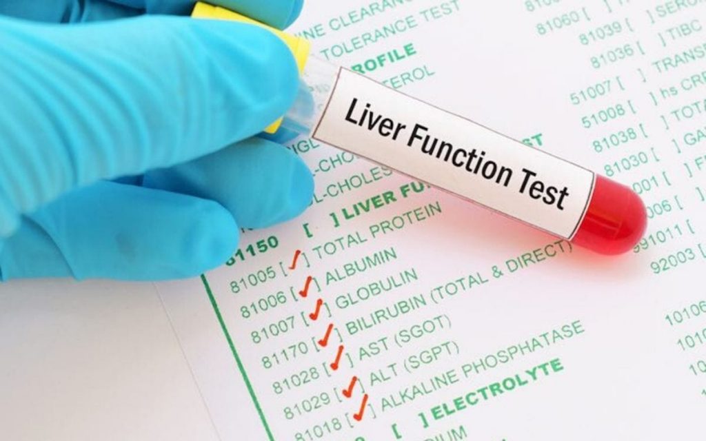 Liver Function Test